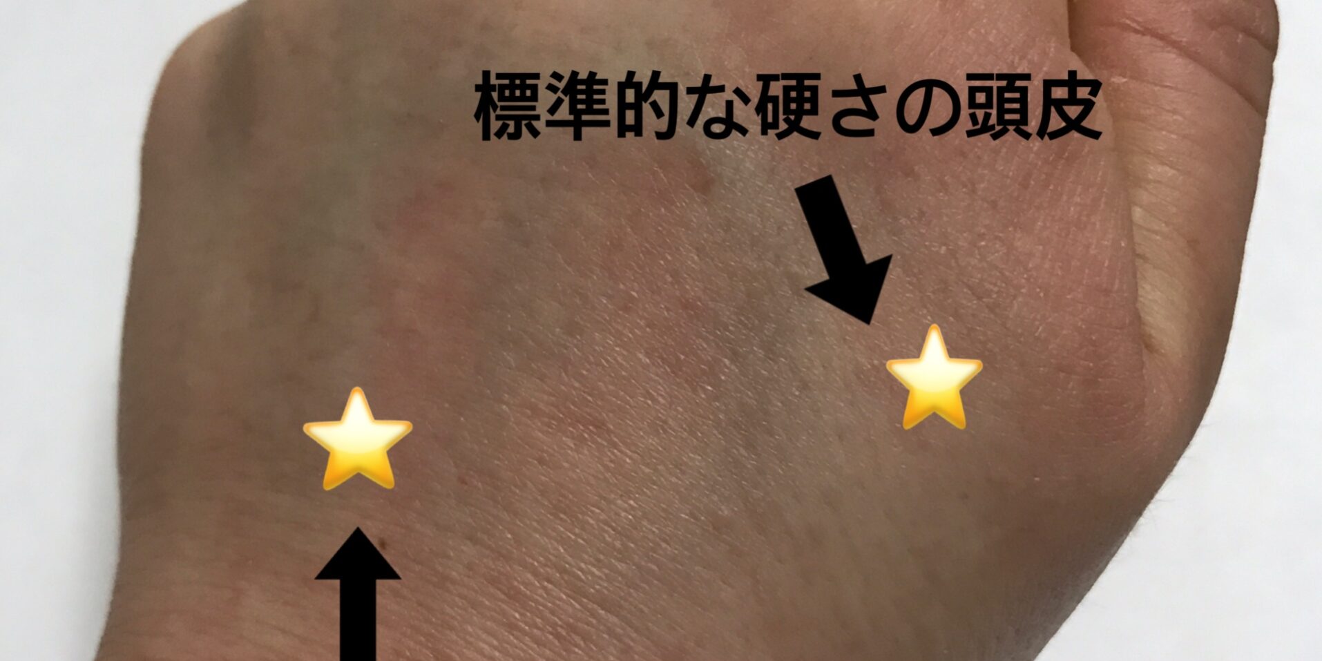 36B3854F-EF16-4BBA-A435-7B5D4F68A8C0